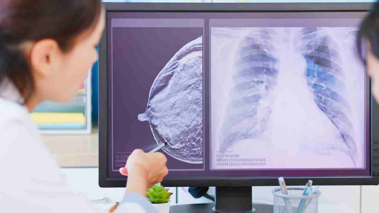 ibrance breast cancer
