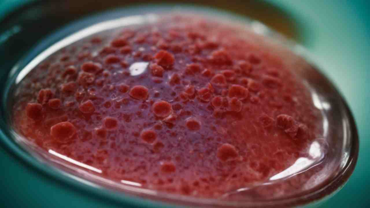 stem cell therapy for alzheimers disease
