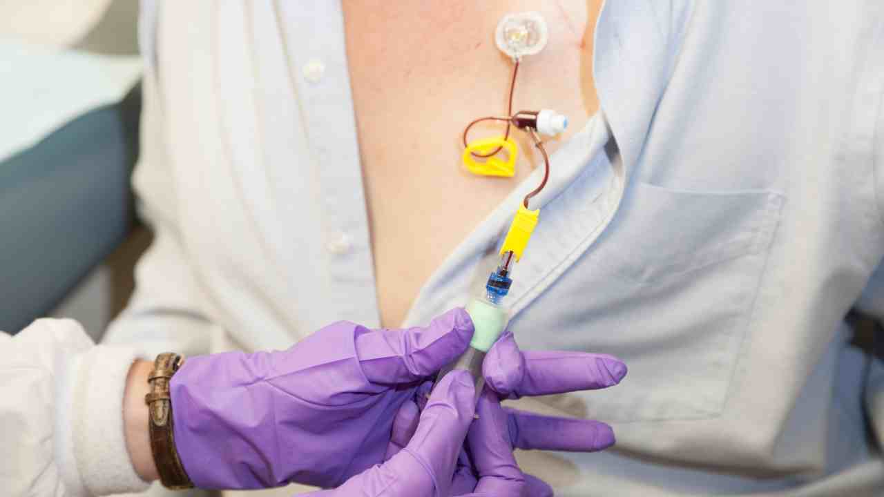 The MonarchE Study and Abemaciclib A Turning Point in Breast Cancer Treatment