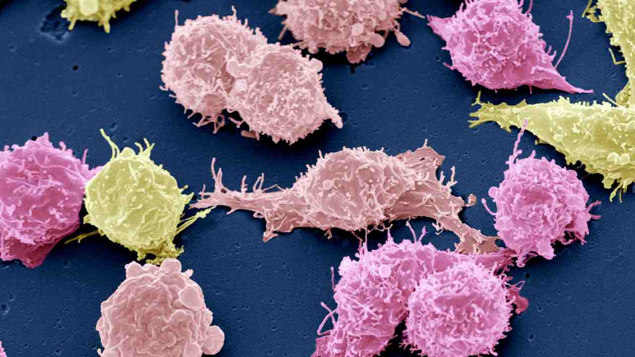yervoy ipilimumab for melanoma immune checkpoint blockade